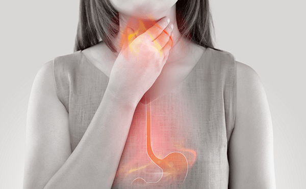 What is Heartburn? And Is It the Same as Acid Reflux?