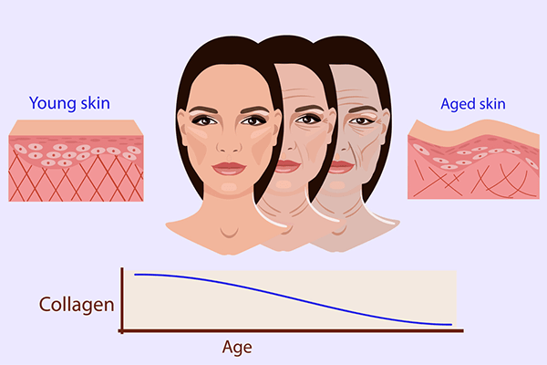 Anti-Aging Tips: Try Collagen